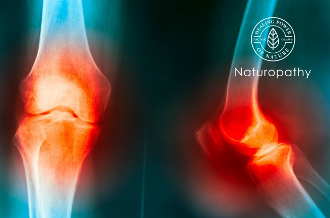 knee joint pain cause by knee truma,gout,rheumatoid,osteoarthritis of knee