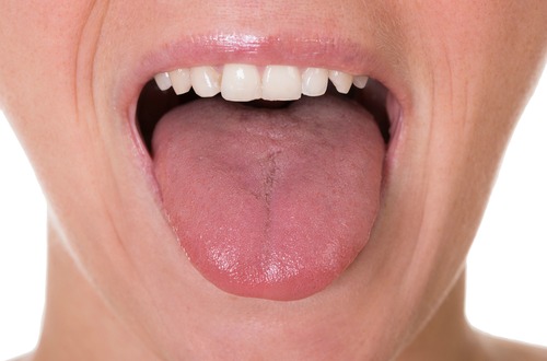 tongue M