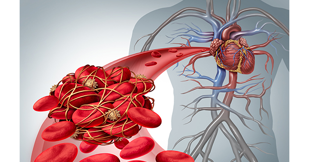 ホモシステインレベルが高くなる原因