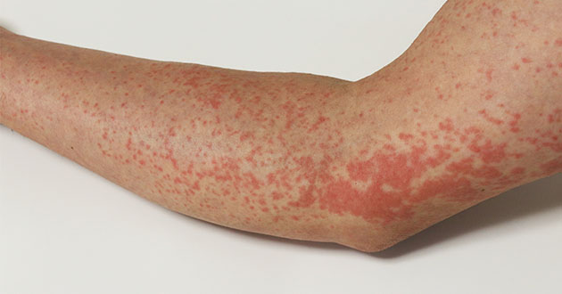 多形光噴出とは何ですか?